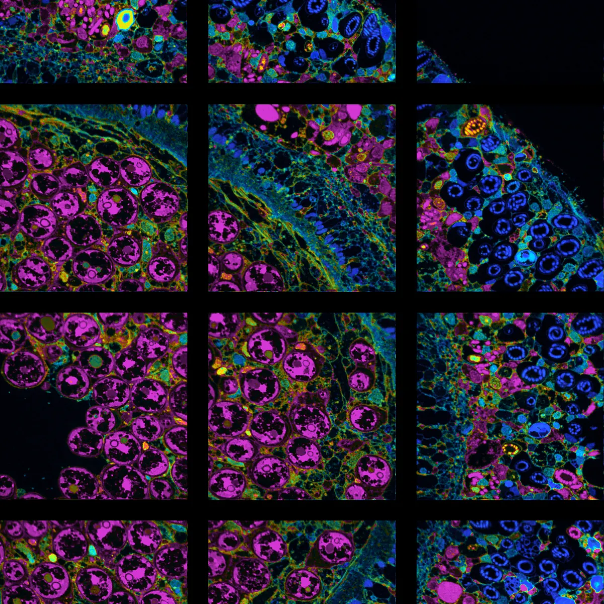 Tiled fluorescence image of cnidarian tissue, with host nuclei in blue and algal cells in magenta